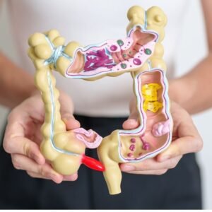 síndrome de intestino irritable psicológico